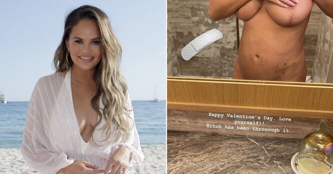 chrissyteigen